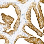 A21195: Prostatic Acid Phosphatase (PSAP) Rabbit mAb