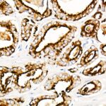 Prostatic Acid Phosphatase (PSAP) Rabbit mAb (Catalog Number: A21195) Abclonal