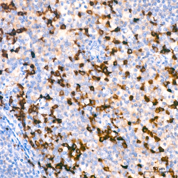 human IgG (Fc) Mouse mAb (Catalog Number: A21215) Abclonal