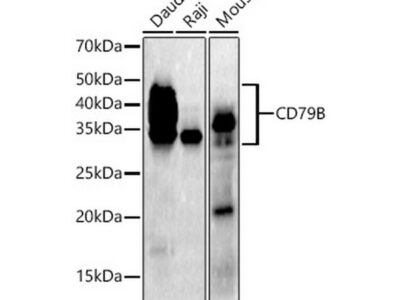 CD79B Rabbit mAb (A21224)