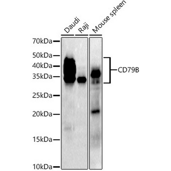 CD79B Rabbit mAb (A21224) CD79B Rabbit mAb (A21224)