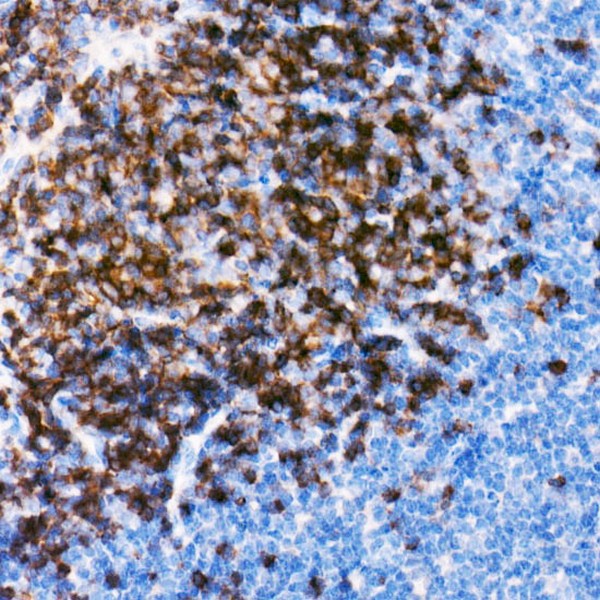 A21224: CD79B Rabbit mAb