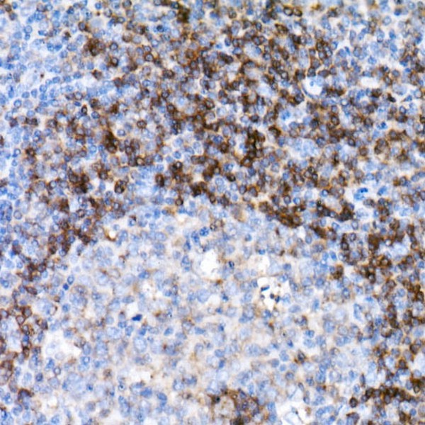 CD79B Rabbit mAb (Catalog Number: A21224) Abclonal