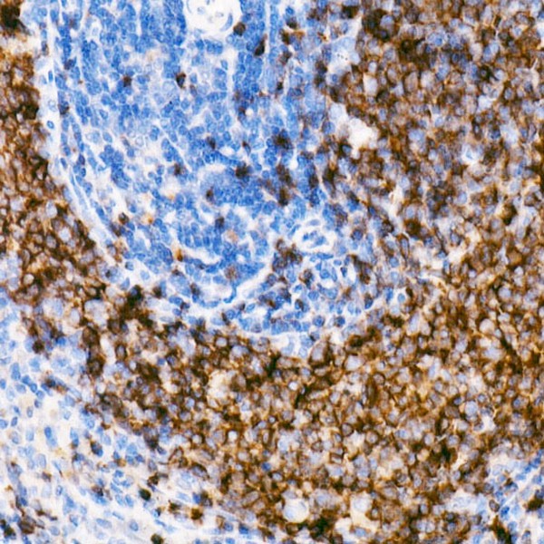 Abclonal CD79B Rabbit mAb (Catalog Number: A21224)