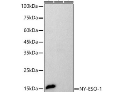 NY-ESO-1 Rabbit mAb (A21229)