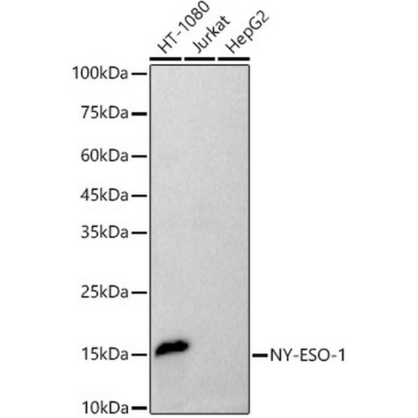 NY-ESO-1 Rabbit mAb (A21229) NY-ESO-1 Rabbit mAb (A21229)