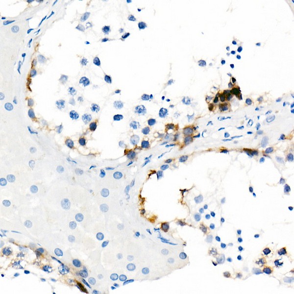 A21229: NY-ESO-1 Rabbit mAb