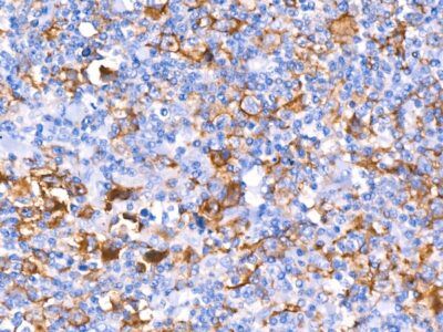 CD30 Rabbit mAb (A21230)