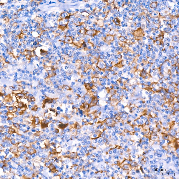 A21230-1 CD30 Rabbit mAb (A21230)