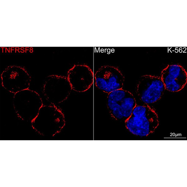 CD30 Rabbit mAb (Catalog Number: A21230) Abclonal