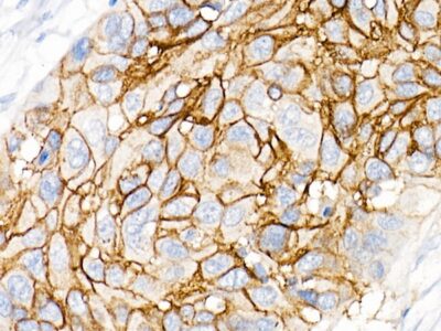 CD141/Thrombomodulin Rabbit mAb (A21238)