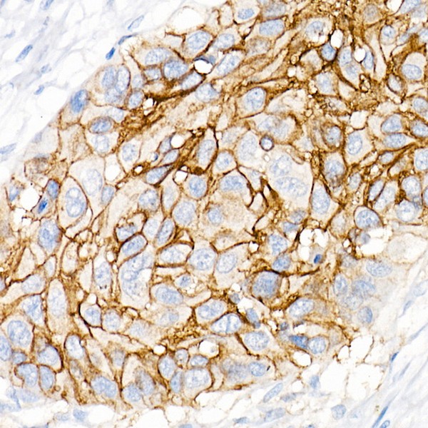 CD141/Thrombomodulin Rabbit mAb (A21238) CD141/Thrombomodulin Rabbit mAb (A21238)