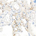 A21238: CD141/Thrombomodulin Rabbit mAb