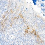 CD141/Thrombomodulin Rabbit mAb (Catalog Number: A21238) Abclonal