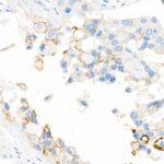 Abclonal CD141/Thrombomodulin Rabbit mAb (Catalog Number: A21238)