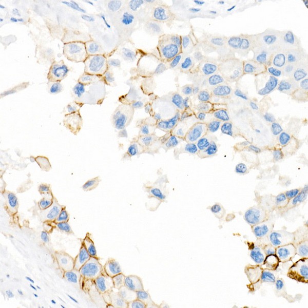 Abclonal CD141/Thrombomodulin Rabbit mAb (Catalog Number: A21238)