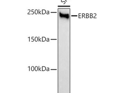 HER2/ErbB2 Rabbit mAb (A21248)