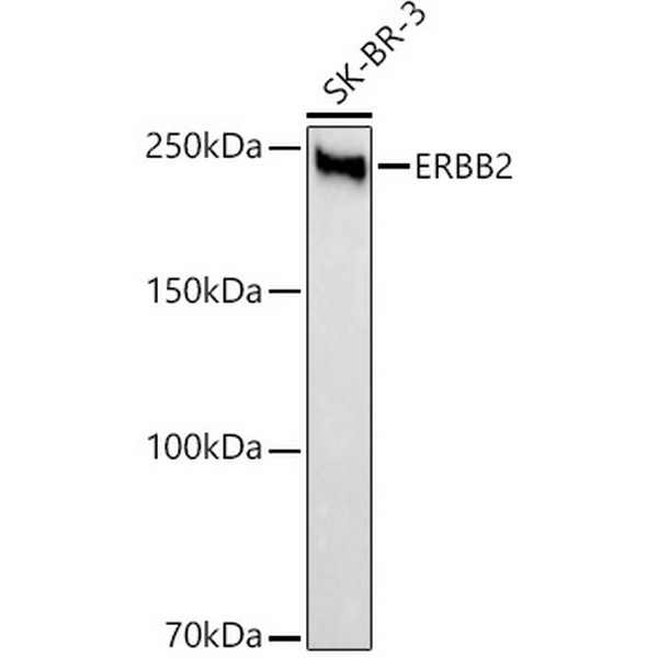 HER2/ErbB2 Rabbit mAb (A21248) HER2/ErbB2 Rabbit mAb (A21248)