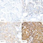A21248: HER2/ErbB2 Rabbit mAb