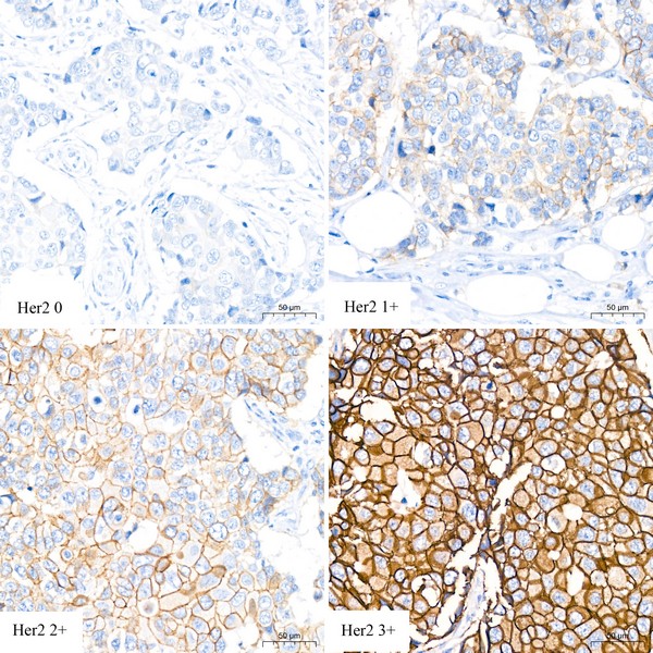 A21248: HER2/ErbB2 Rabbit mAb