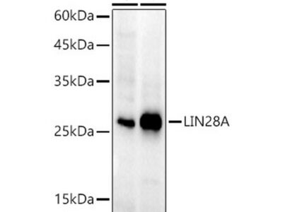 LIN28A Rabbit mAb (A21261)