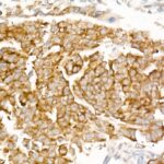 A21261: LIN28A Rabbit mAb