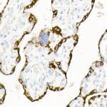 LIN28A Rabbit mAb (Catalog Number: A21261) Abclonal
