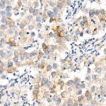Abclonal LIN28A Rabbit mAb (Catalog Number: A21261)