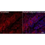 A21267: Tyrosinase Rabbit mAb