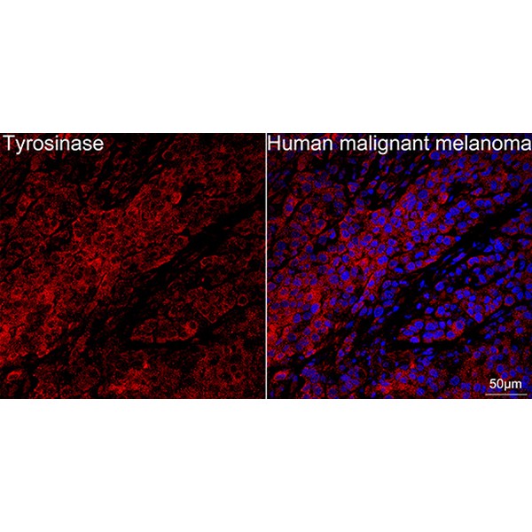 A21267: Tyrosinase Rabbit mAb