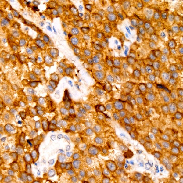 A21267 Tyrosinase Rabbit mAb (A21267)