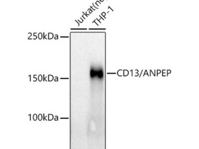 CD13/ANPEP Rabbit mAb (A21268)