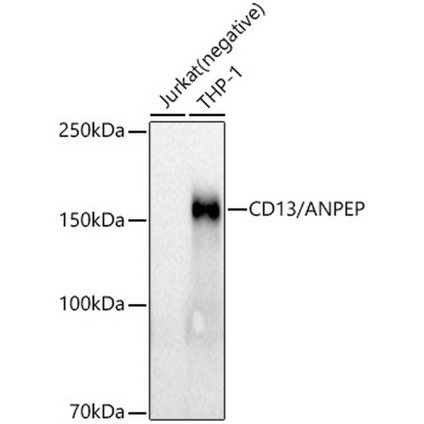CD13/ANPEP Rabbit mAb (A21268) CD13/ANPEP Rabbit mAb (A21268)