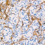 CD13/ANPEP Rabbit mAb (Catalog Number: A21268) Abclonal