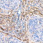 Abclonal CD13/ANPEP Rabbit mAb (Catalog Number: A21268)
