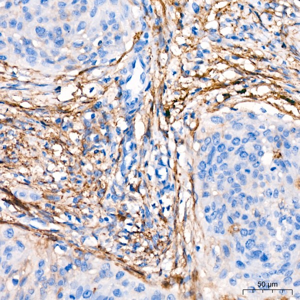 Abclonal CD13/ANPEP Rabbit mAb (Catalog Number: A21268)