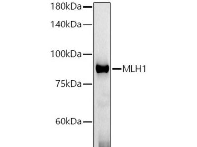 [KO Validated] MLH1 Mouse mAb (A21882)