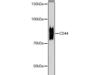 CD44 Rabbit mAb (A21919)