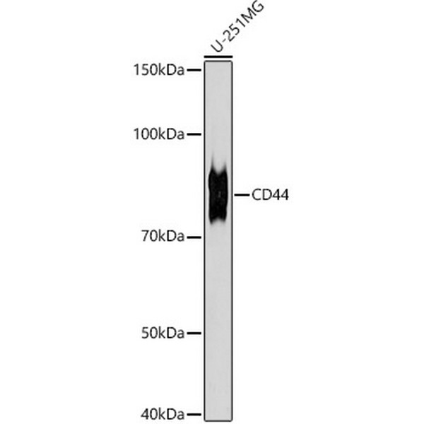 CD44 Rabbit mAb (A21919) CD44 Rabbit mAb (A21919)