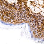 CD44 Rabbit mAb (Catalog Number: A21919) Abclonal