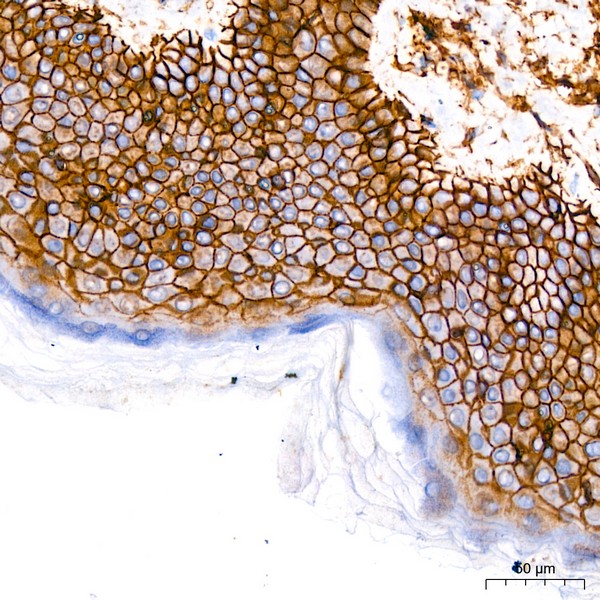 CD44 Rabbit mAb (Catalog Number: A21919) Abclonal