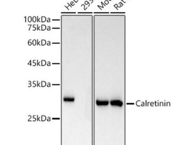 Calretinin Rabbit mAb (A22010)