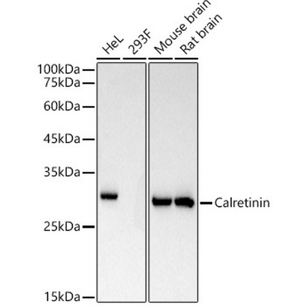 Calretinin Rabbit mAb (A22010) Calretinin Rabbit mAb (A22010)