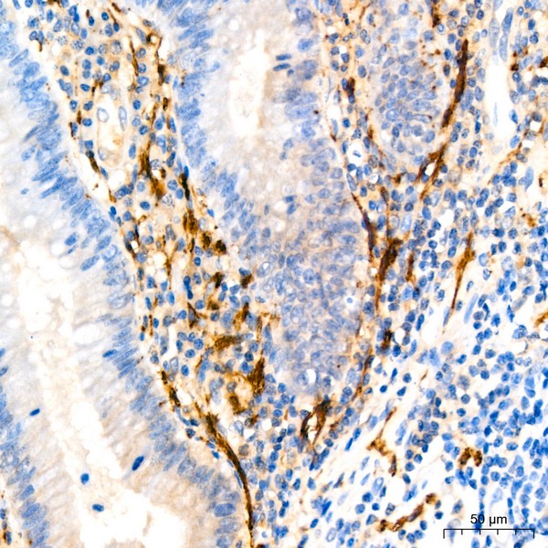 A22010: Calretinin Rabbit mAb