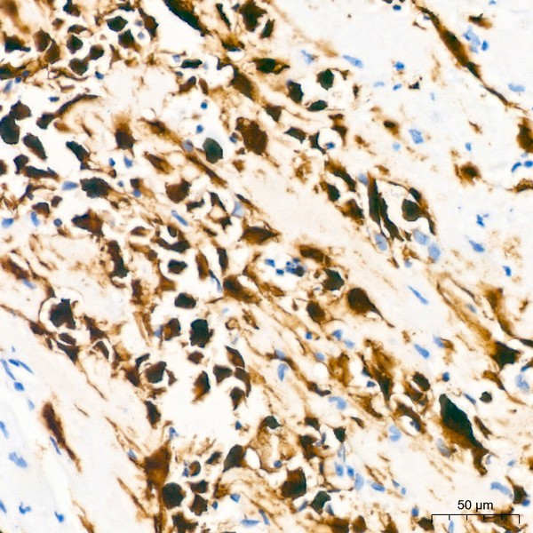 Calretinin Rabbit mAb (Catalog Number: A22010) Abclonal