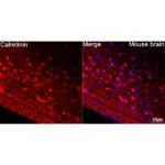 Abclonal Calretinin Rabbit mAb (Catalog Number: A22010)