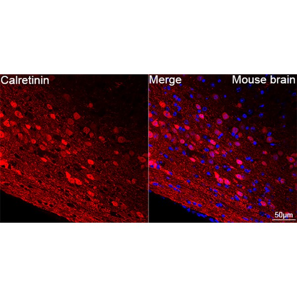 Abclonal Calretinin Rabbit mAb (Catalog Number: A22010)