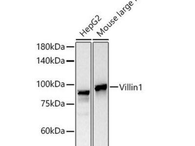 Villin Rabbit mAb (A22051)