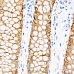 Abclonal Villin Rabbit mAb (Catalog Number: A22051)