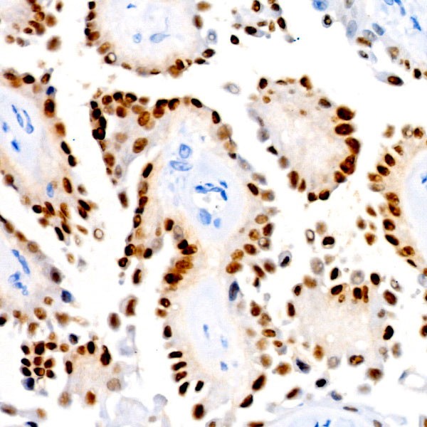 PAX8 Rabbit mAb (A22164) PAX8 Rabbit mAb (A22164)